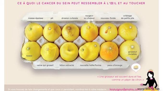 What Does Breast Cancer Look Like? Here is the photo that will help you detect it. 
