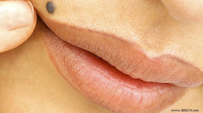 How to Lighten Hair Above Lips. 