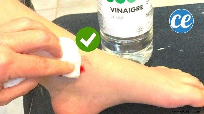 White Vinegar:An Effective Healing Agent No One Knows About! 