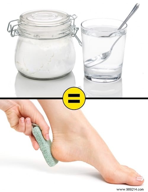10 MIRACLE Remedies for Dry and Cracked Heels. 