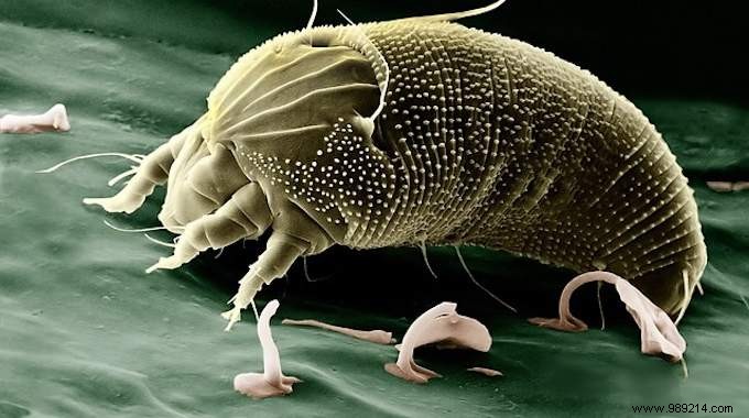 2 Natural &Economical Solutions to Get Rid of Dust Mites. 