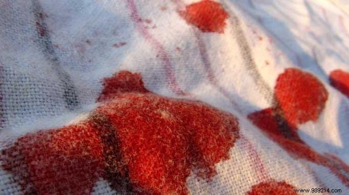 The Effective Trick to Clean a Bloodstain. 