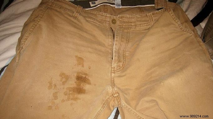 The Genius Tip for Removing Greasy Stains from Laundry. 