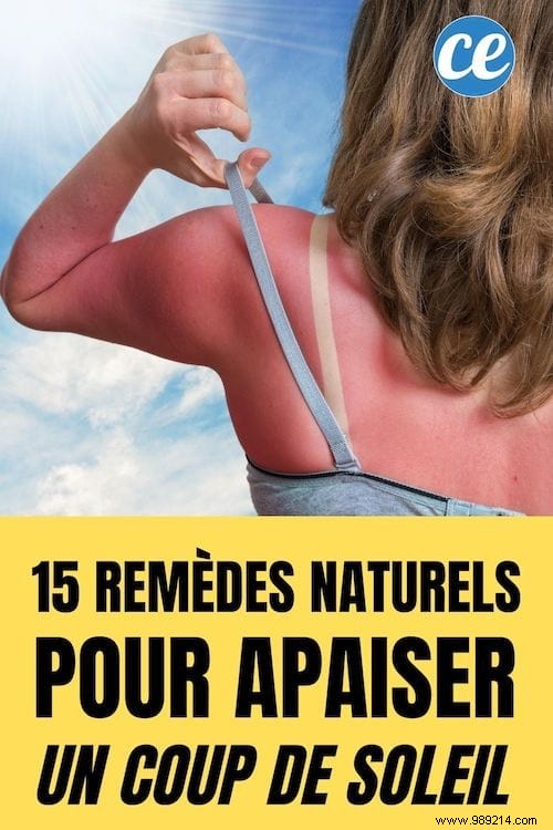 15 Natural Remedies To Relieve A Sunburn WITHOUT Biafine. 