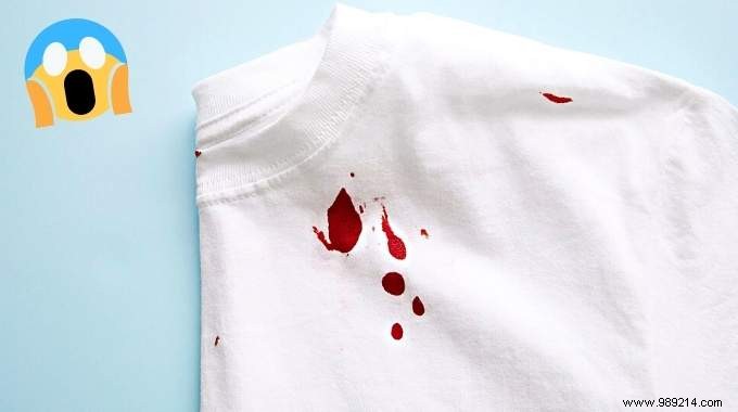 Bloodstain On A White Clothes:7 Tips To Remove It Easily. 