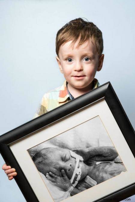 17 Photos of Premature Babies Who Hold Photo Two When They Were Babies. 