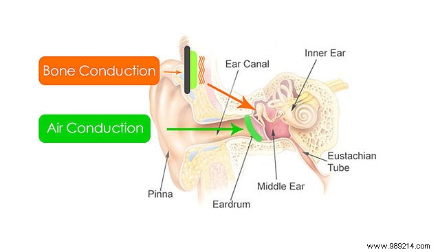 Bone Conduction Technology:How It Works and Where It s Used 