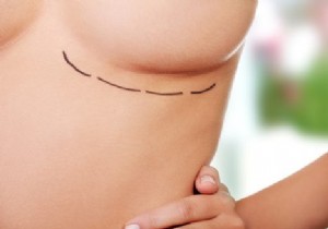 Netherlands Mandates Breast Implant Registration Starting Late This Year