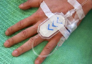 Chemotherapy too long 