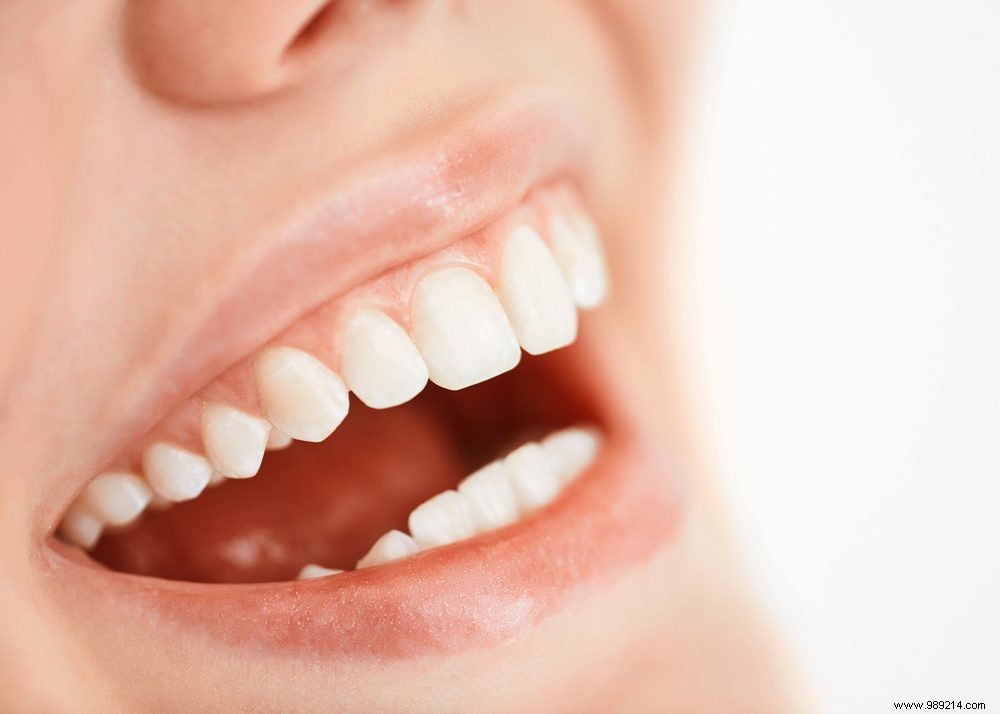 3x food that is good for your teeth 