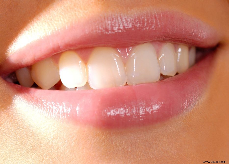 4 tips against inflamed gums 