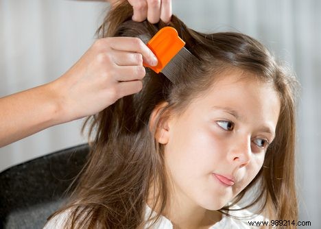 What can you do to prevent lice? 