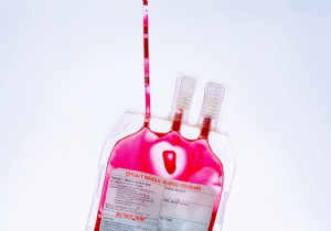 Living Donations: What You Can Give While Still Alive – Blood, Kidneys, Hair, and More