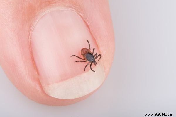 Here s what to watch out for with a tick bite 