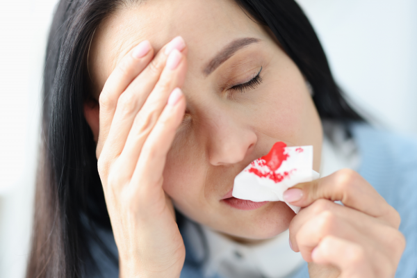 5 possible causes of a nosebleed 