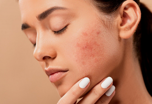 These are the very best skin care tips 