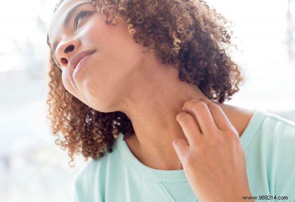 8 tips against eczema that really help 