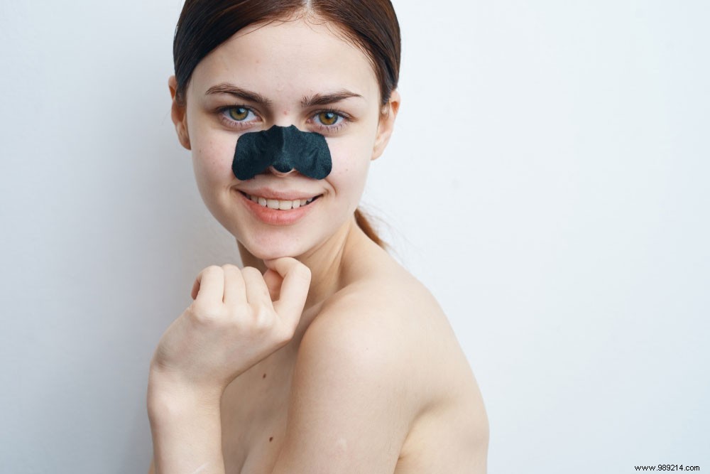 What are blackheads? 