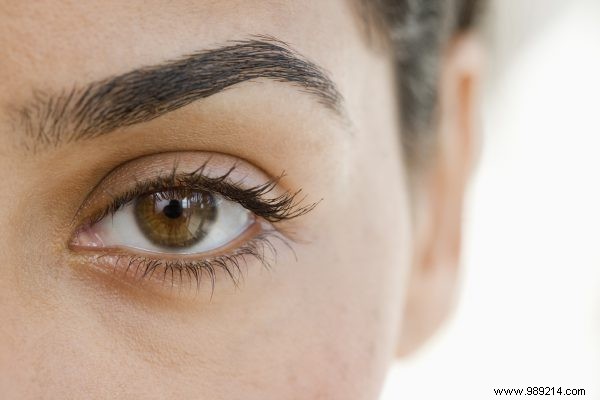What can you do about flakes in your eyebrows? 