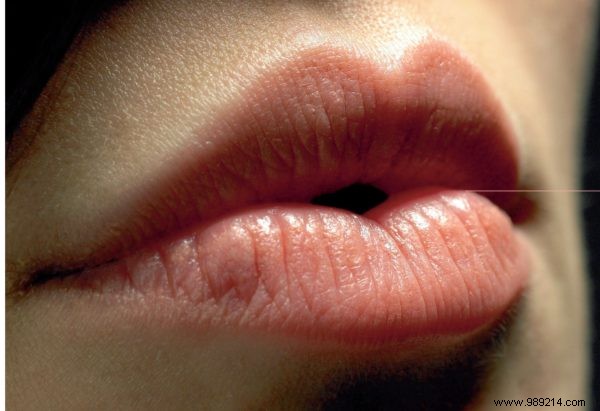 7 solutions against cold sores 