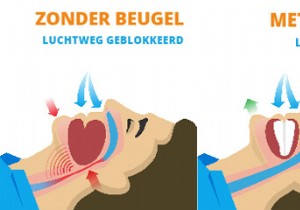 The anti-snoring mouthpiece puts an end to your nighttime hell 