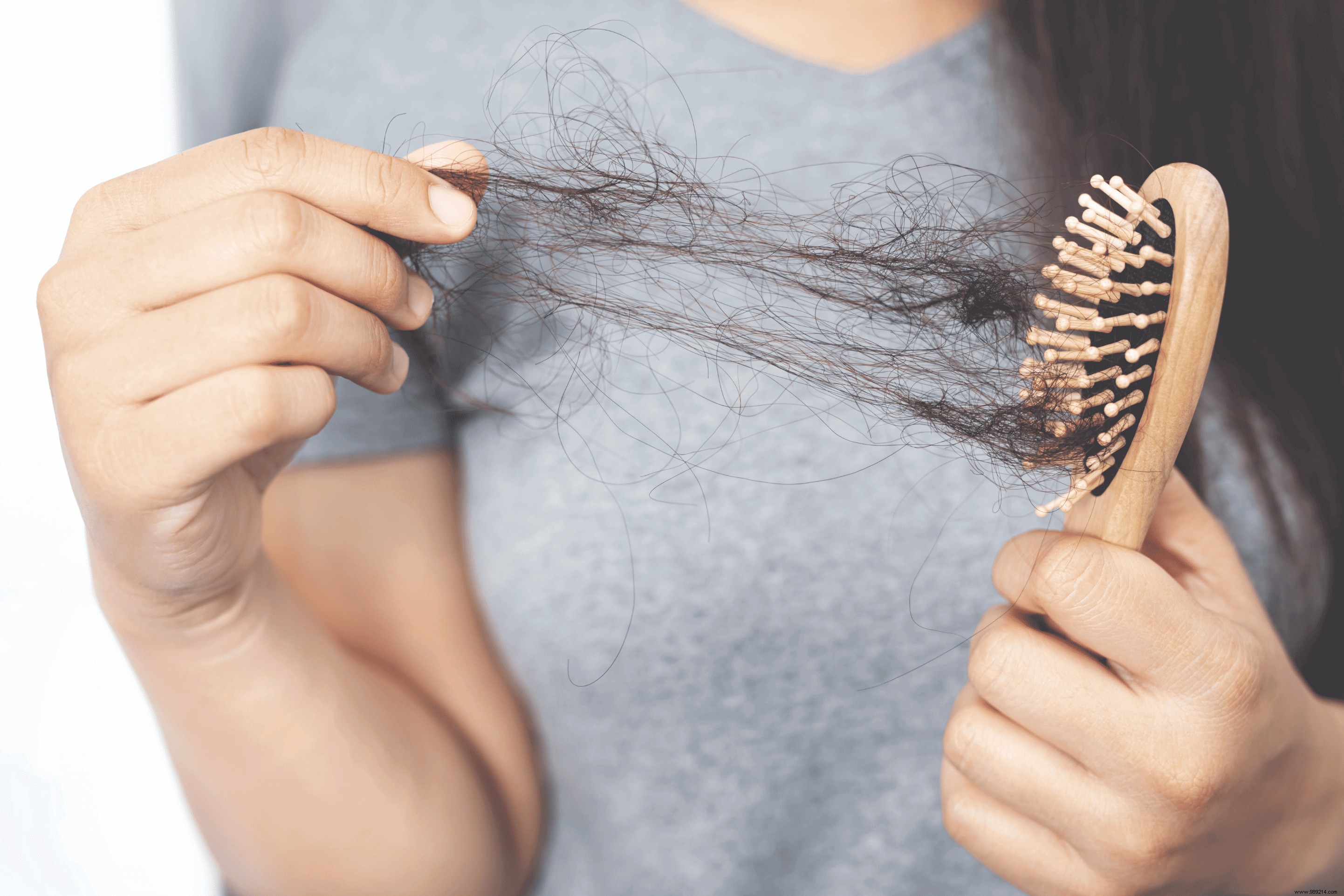 How to prevent seasonal hair loss? 