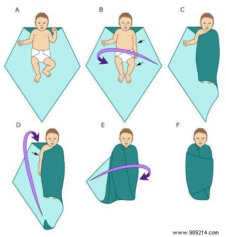 Swaddling baby:is it really useful? 