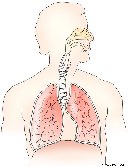 Asthmatic bronchitis:definition, causes and treatments 