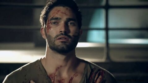 Teen Wolf:what happens to the actors of the series? 