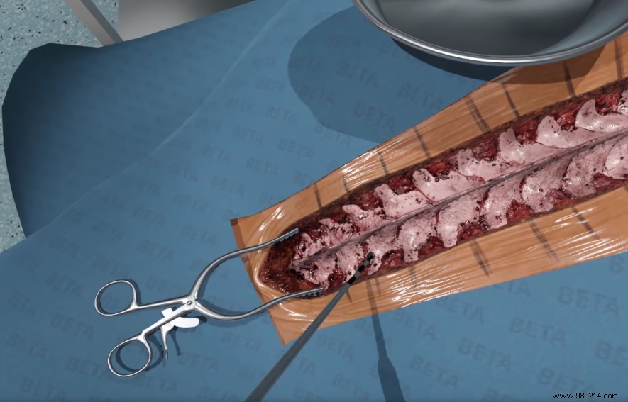 Here is Fundamental Surgery, the high-flying simulation for surgeons! 
