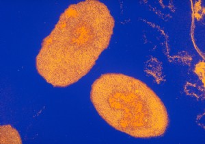 Do we need a new whooping cough vaccine? 