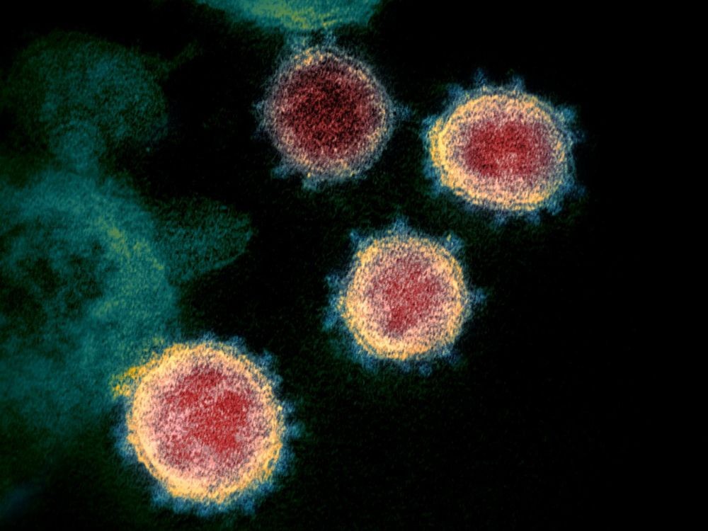 Could the coronavirus disappear with spring? 