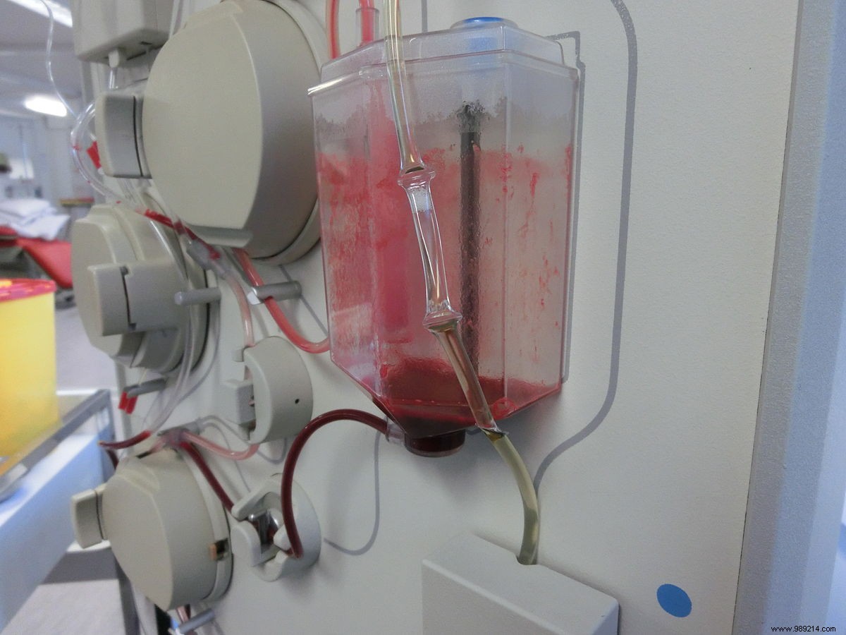 Covid-19:France will test the effectiveness of plasma transfusion of cured patients! 