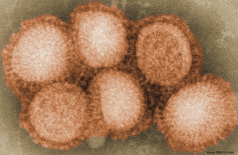 A new virus with pandemic potential in humans discovered in China 