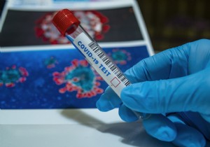 Covid-19:an Israeli doctor tested positive three months after a first recovery 