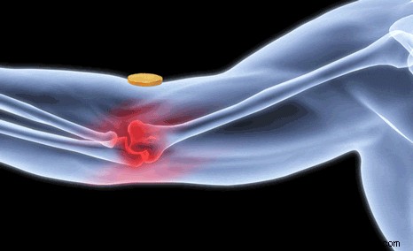 Does magnetism to treat pain have a scientific basis? 