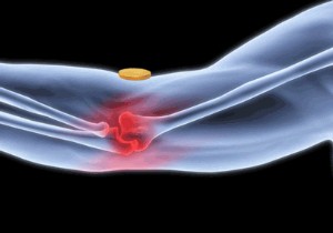 Does Magnetic Therapy for Pain Relief Have a Scientific Basis?