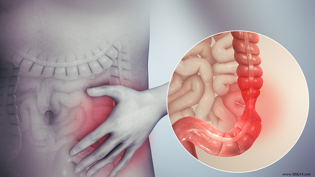We finally know one of the causes of irritable bowel syndrome 