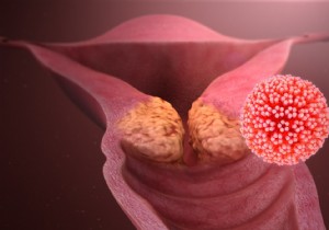 Three Key Vaccine Controversies Shaping French Public Mistrust