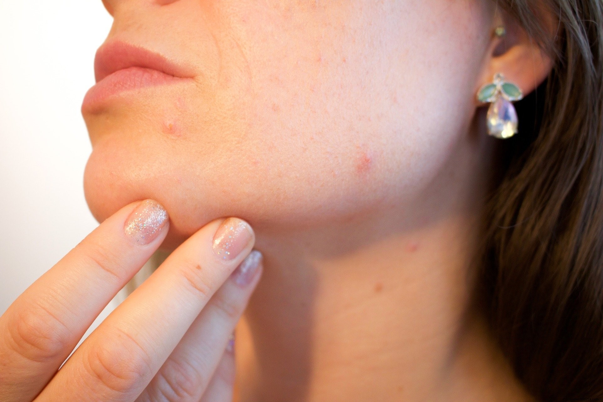 Google announces a tool to identify skin problems 