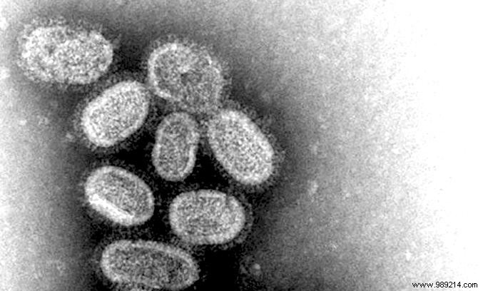Two strains of flu virus may have disappeared 