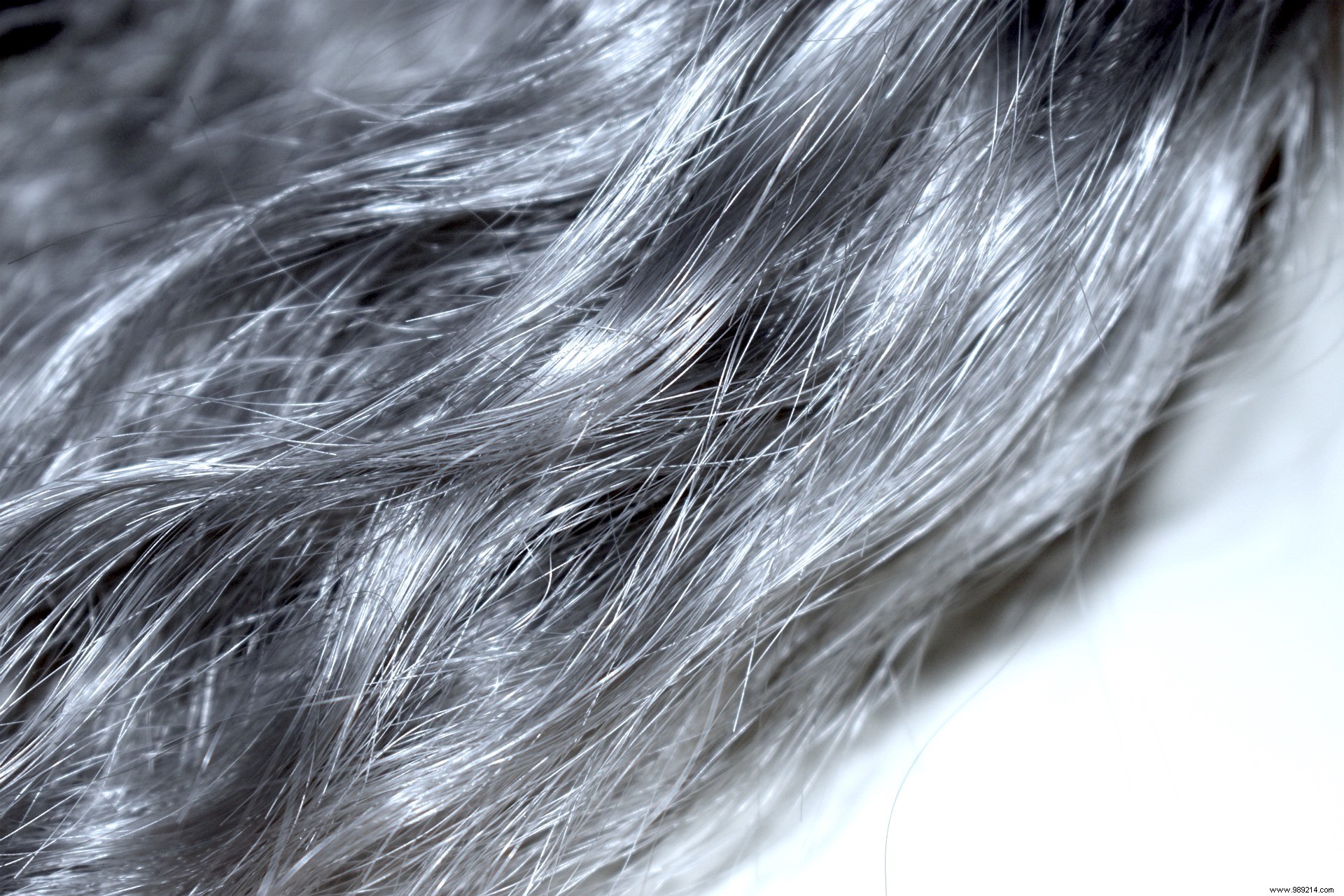 Reducing stress can sometimes reverse gray hair, study finds 