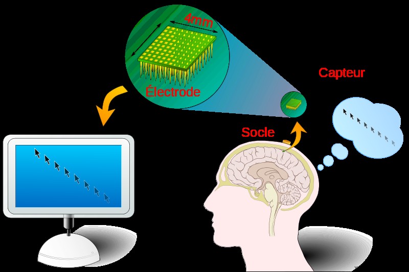 Bio-engineers pessimistic about the future of brain-machine interfaces 