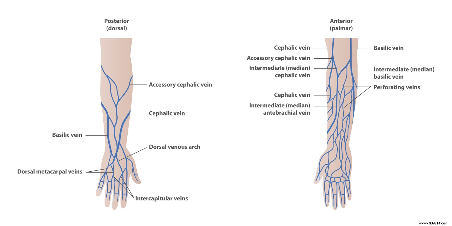 More and more people have an extra artery in the forearm 
