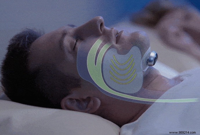 This non-invasive device aims to overcome snoring 