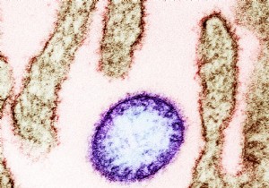 What s going on on  Plague Island  off the coast of Germany? 