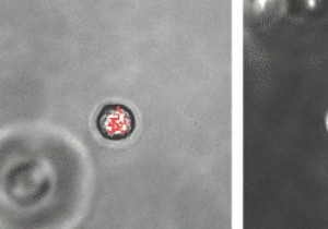 A new type of vital cells discovered in the lungs 